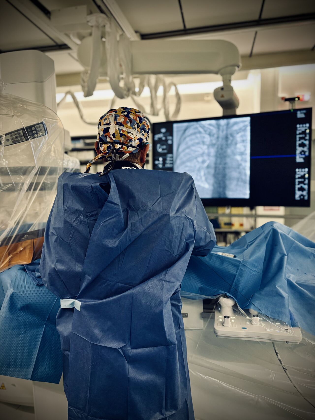 HAPO FRONT: Passive Shoulder & Arm Exoskeleton-thumbnail